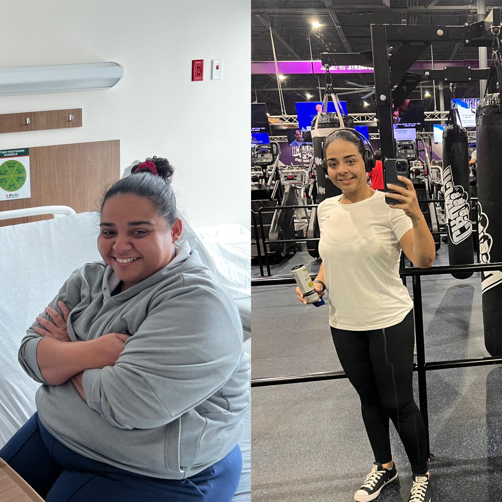 Anjelis before and after — hospital to gym
